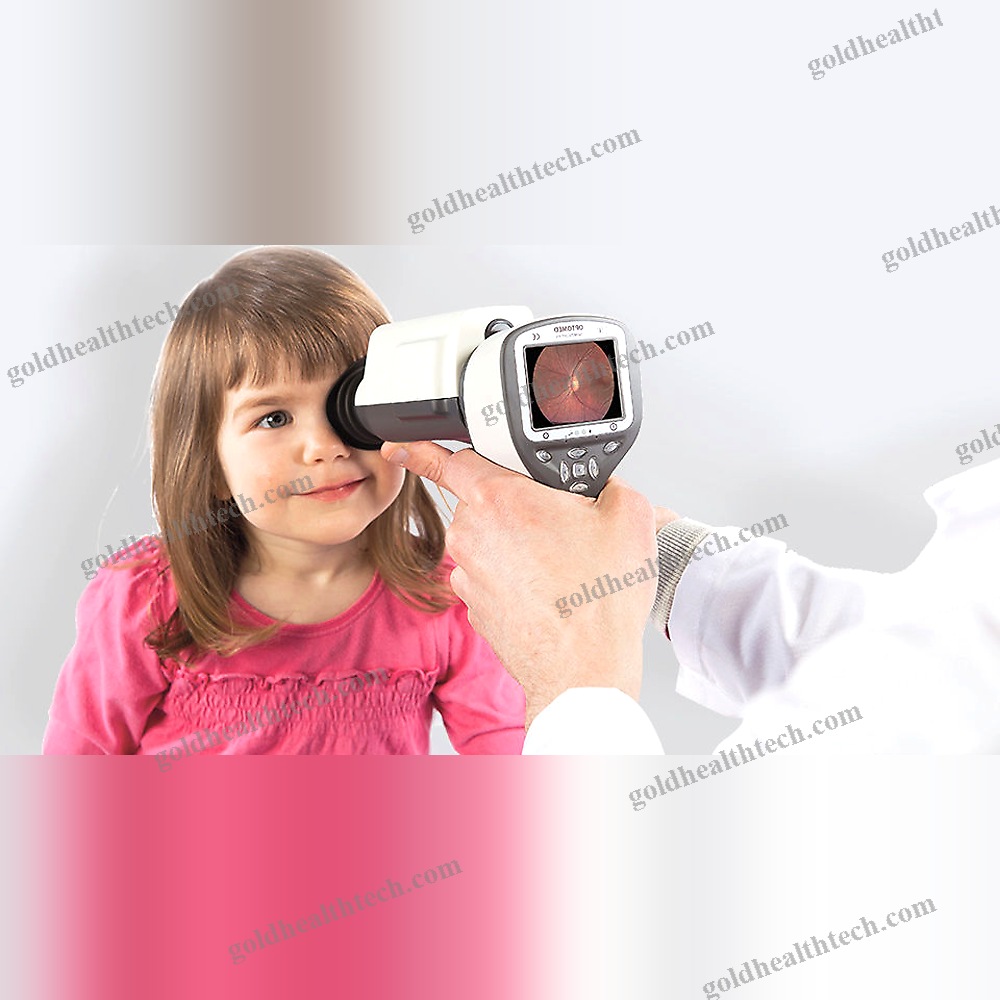 Non-Mydriatic Retinal Camera