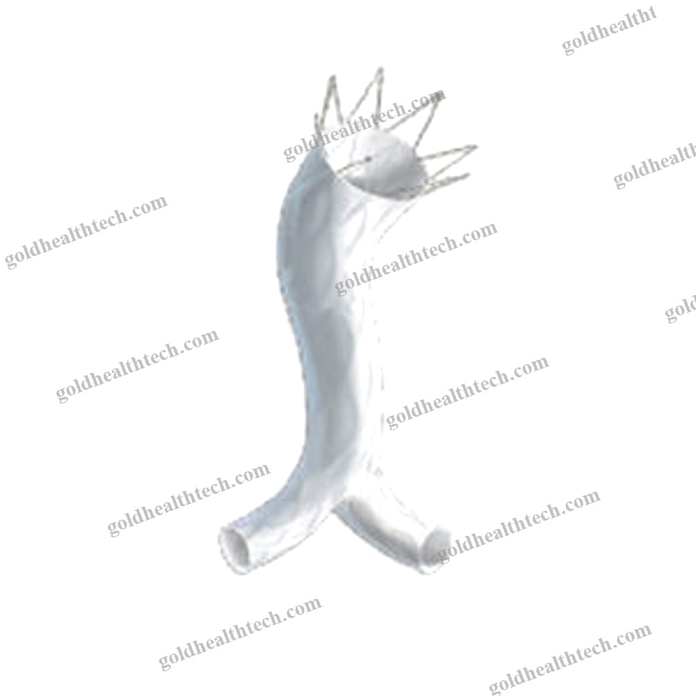Abdominal Aorta Stent Graft