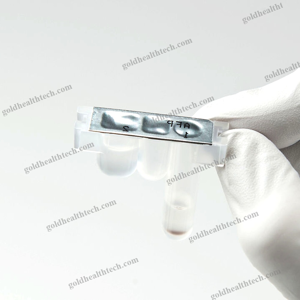 Neurodegenerative Disease Assay Kit