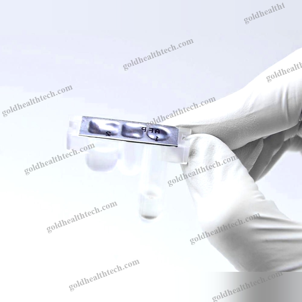Lung Cancer Test Kit