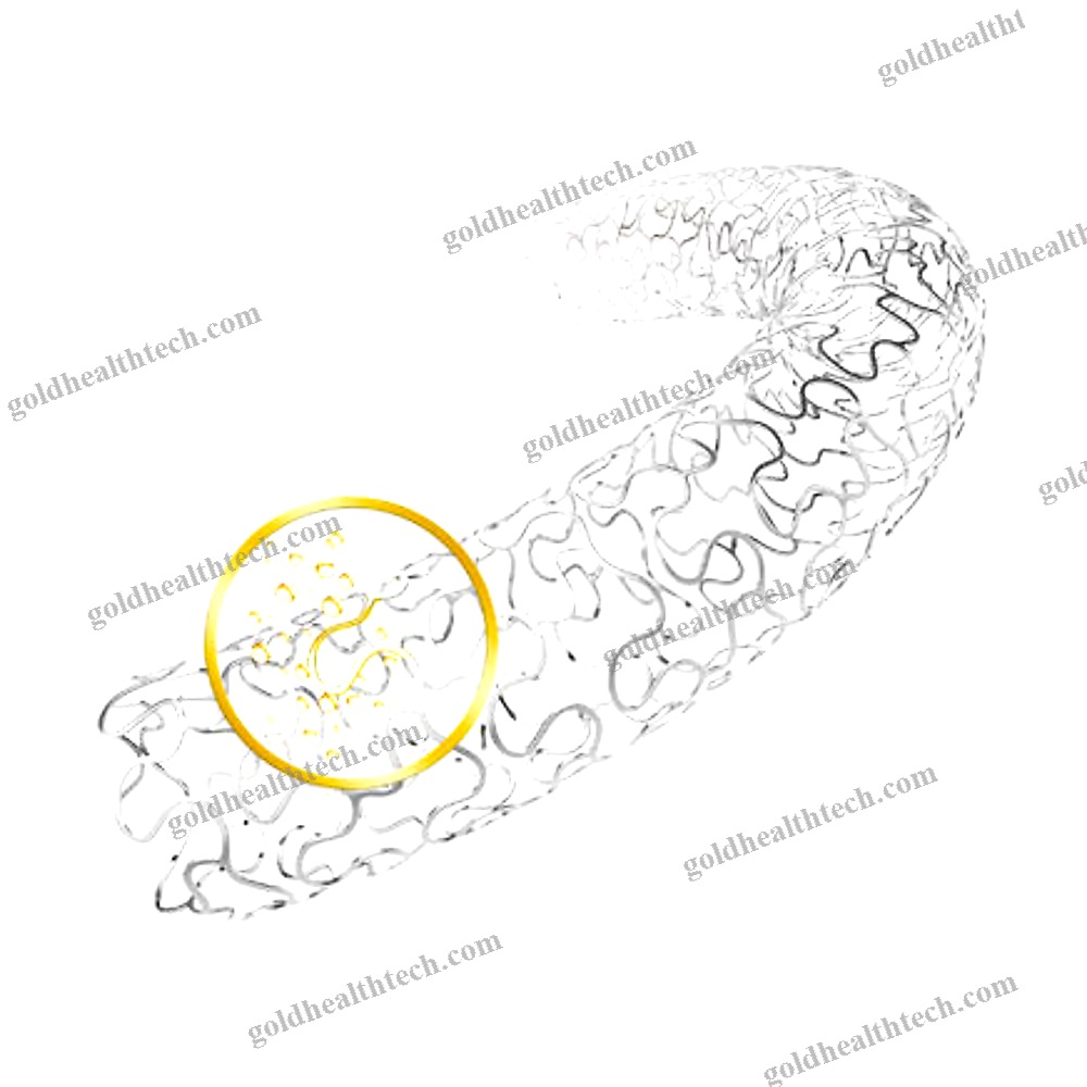 Coronary Stent
