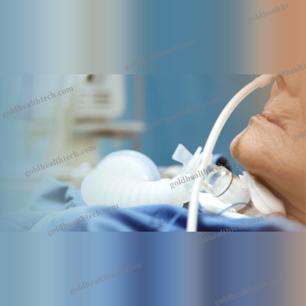 Oxygen Nasal Cannula