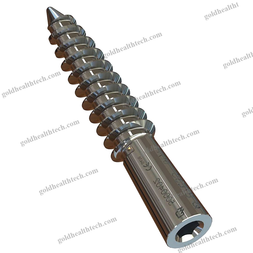 Subtalar Joint Arthrodesis Screw