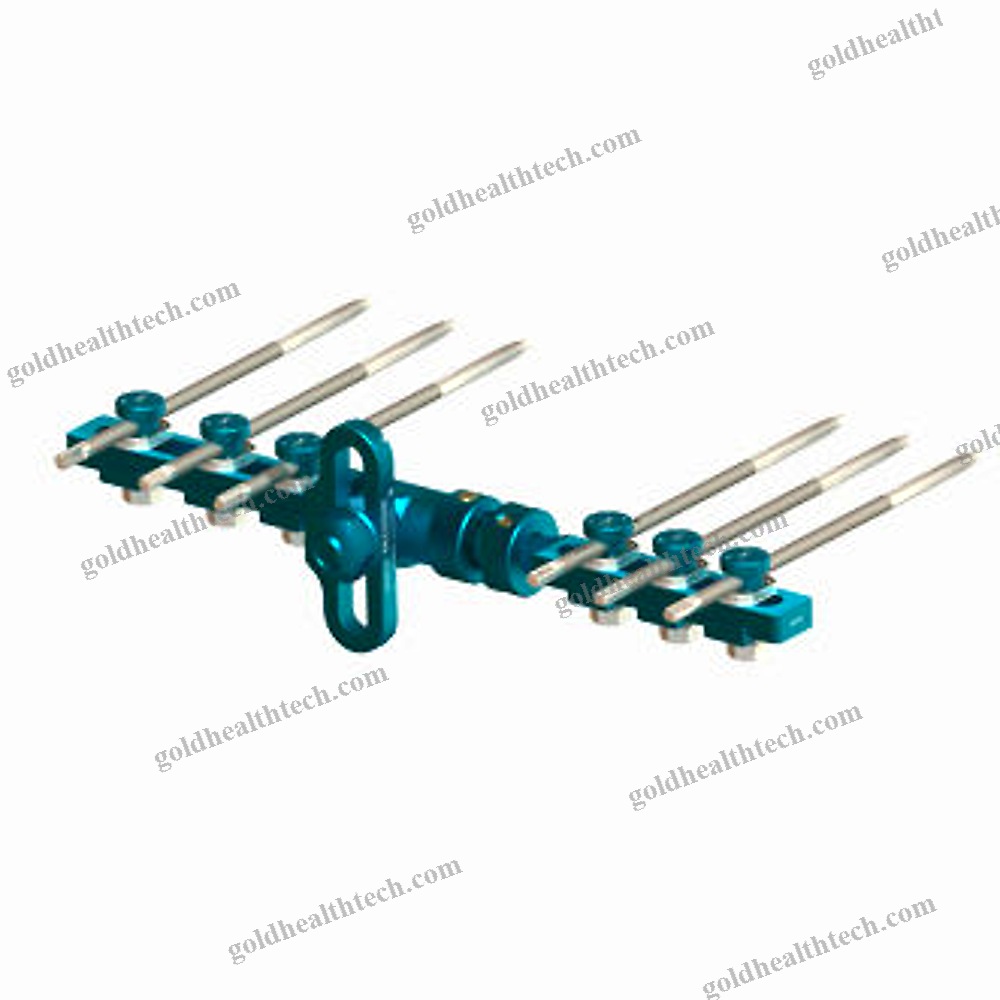 Modular External Fixation System