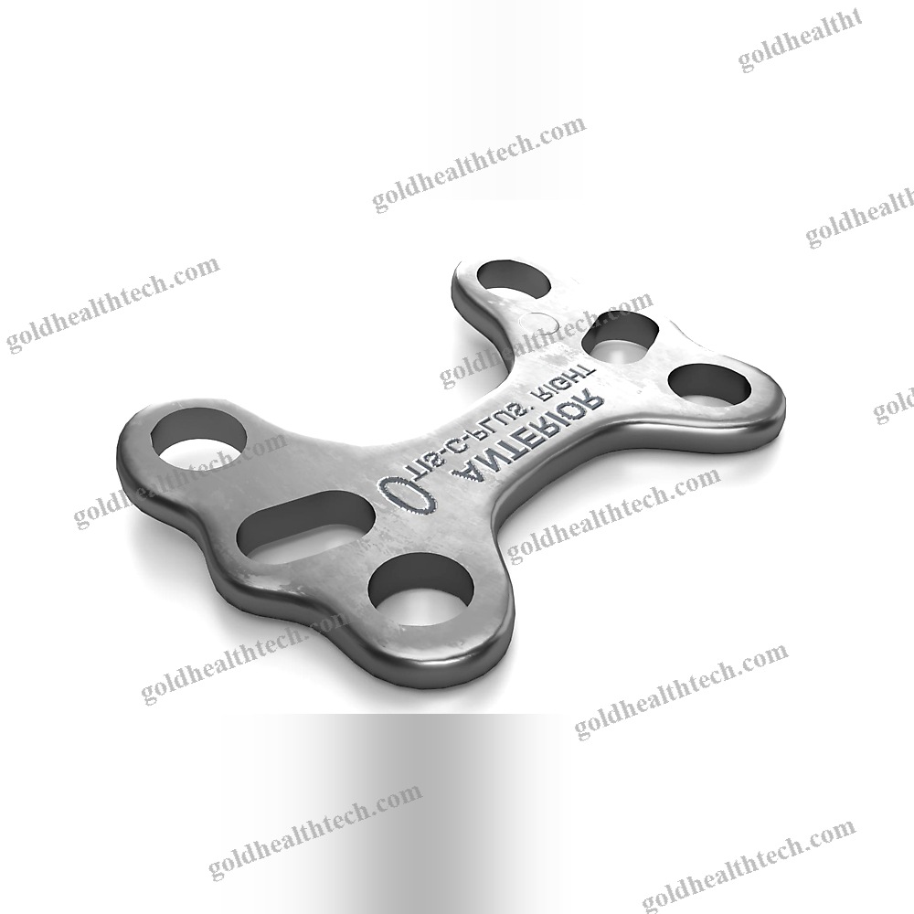 Tibia Osteotomy Plate