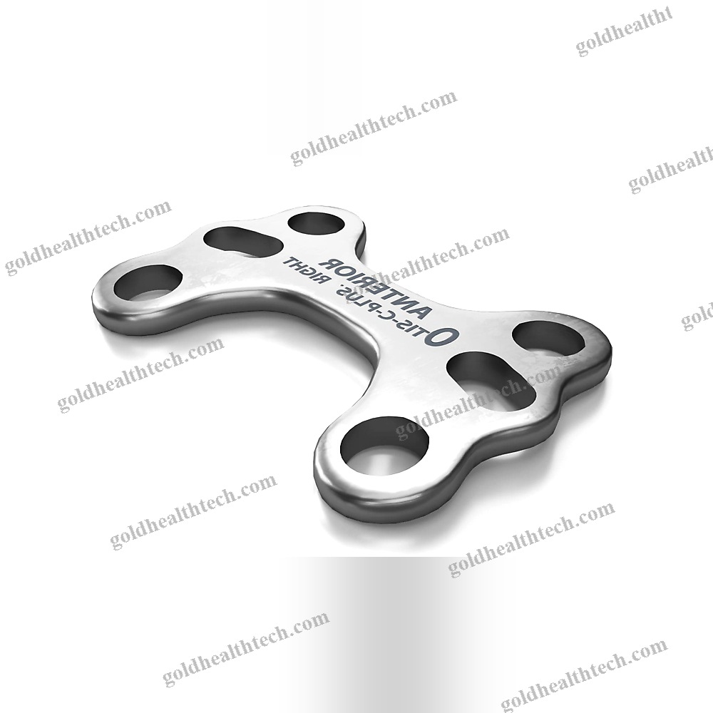 Tibia Osteotomy Plate