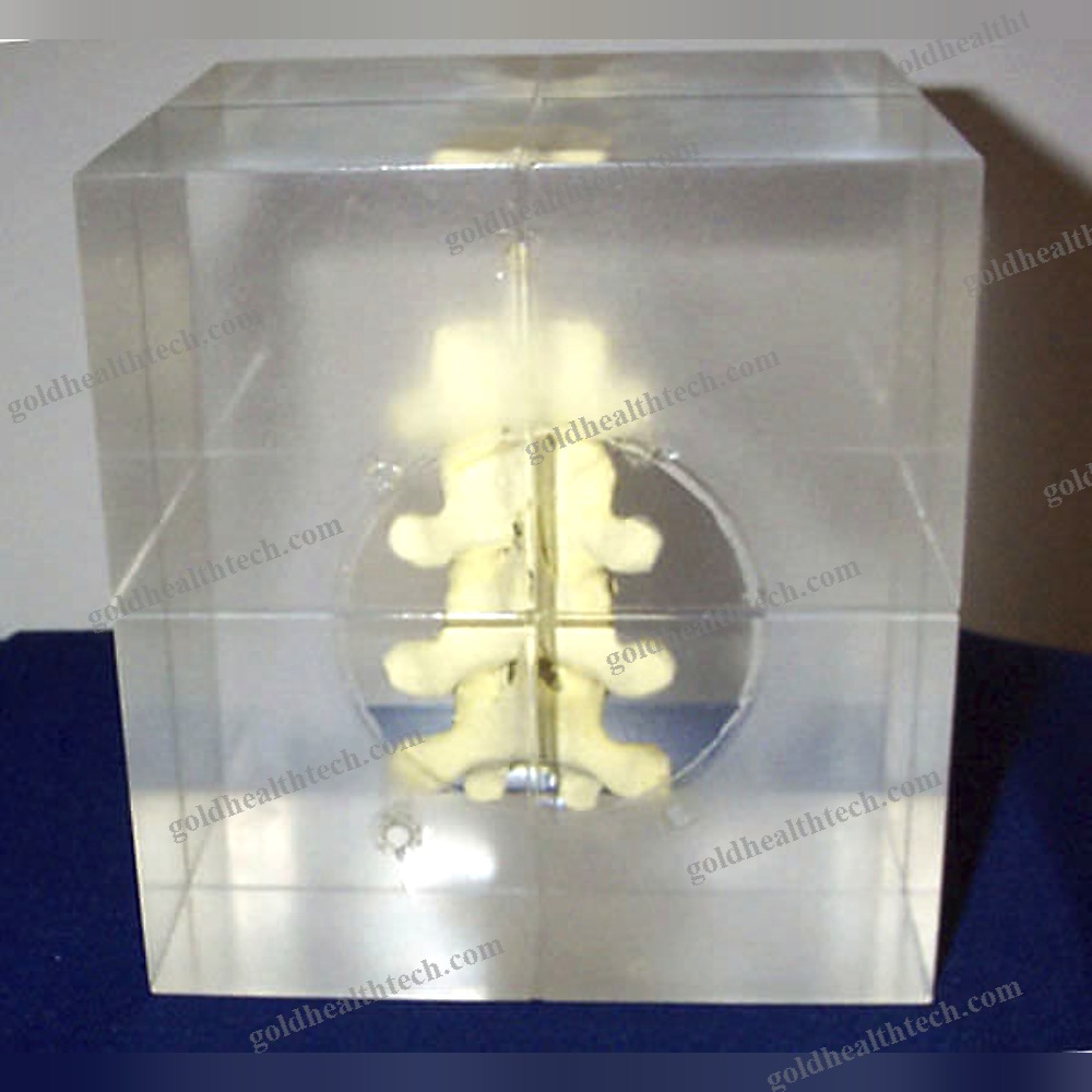 Radiography Test Phantom
