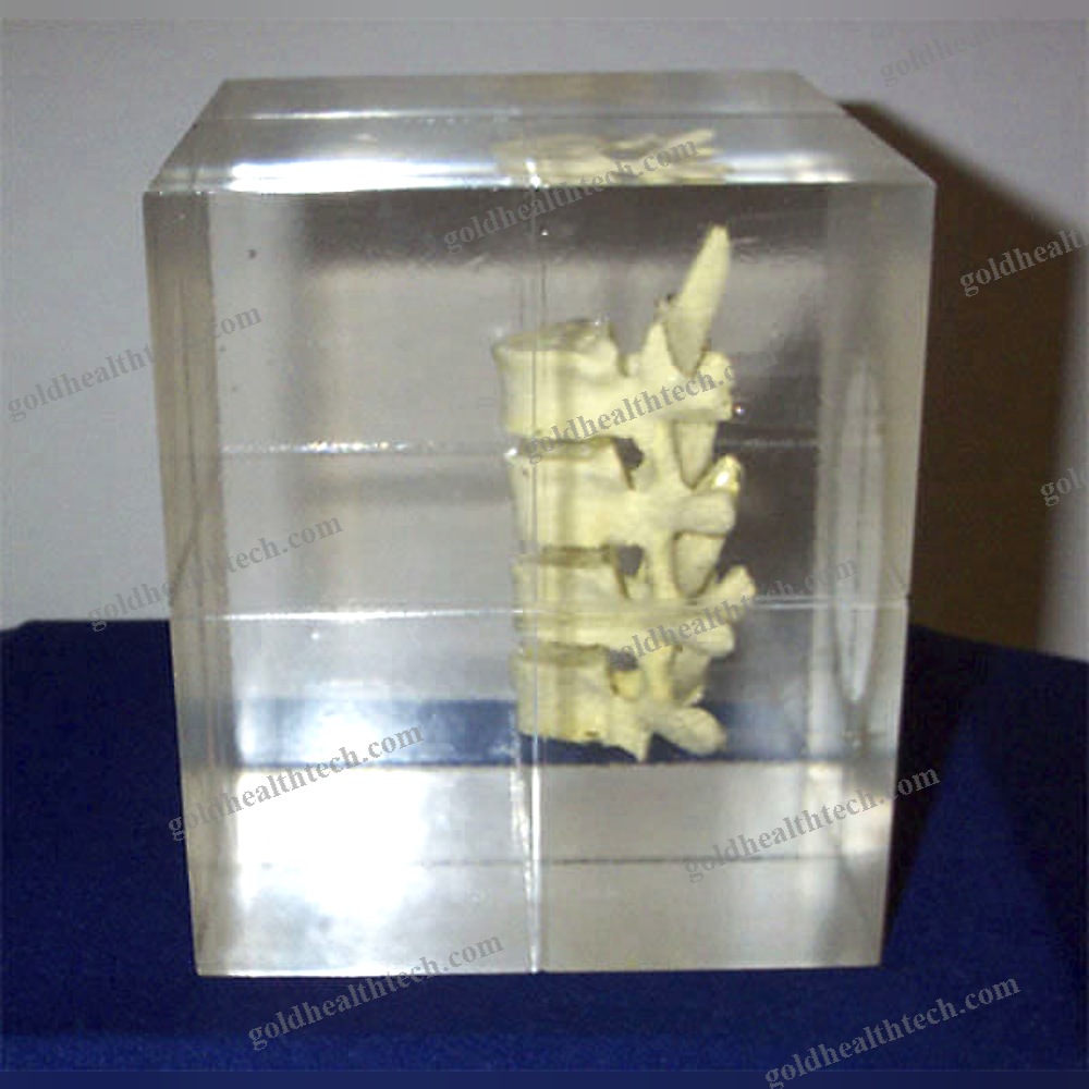 Radiography Test Phantom