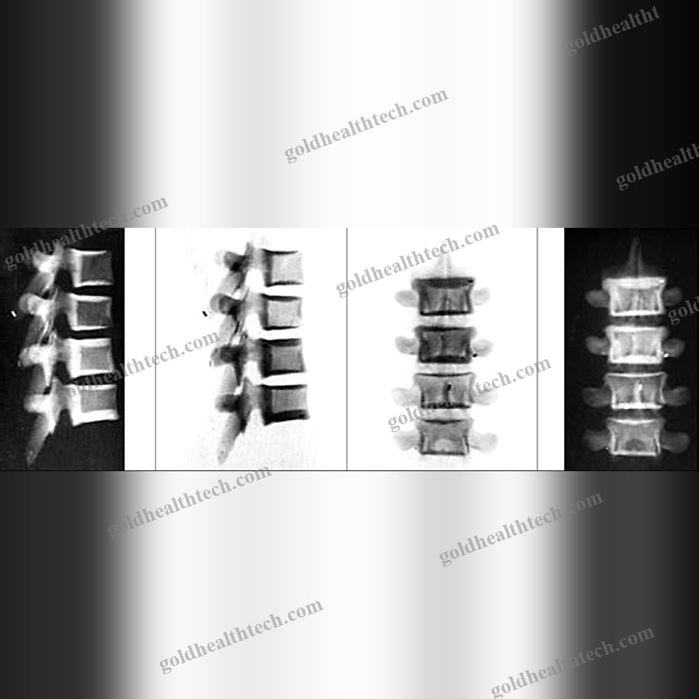 Radiography Test Phantom