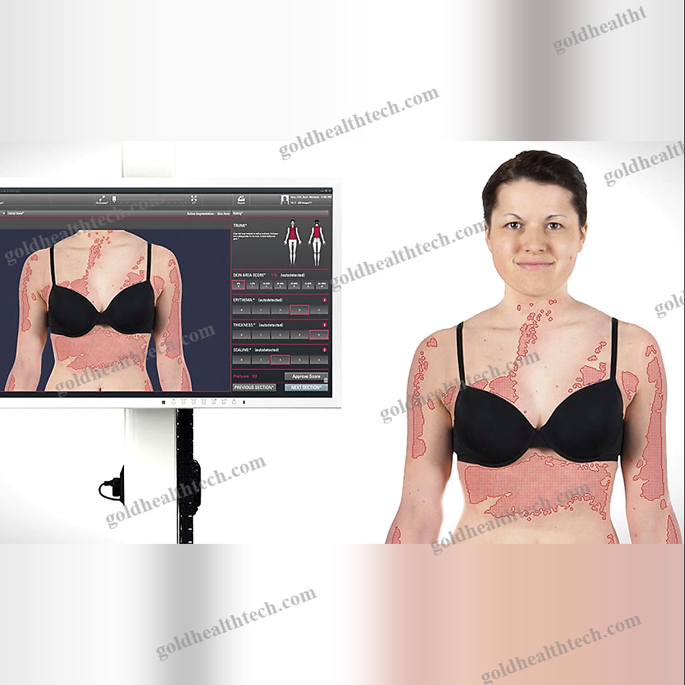 Skin Psoriasis Severity Analysis System