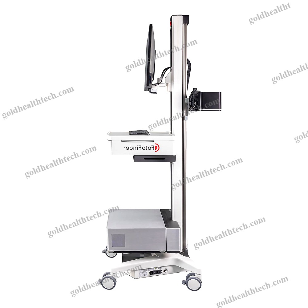 Video Dermatoscope
