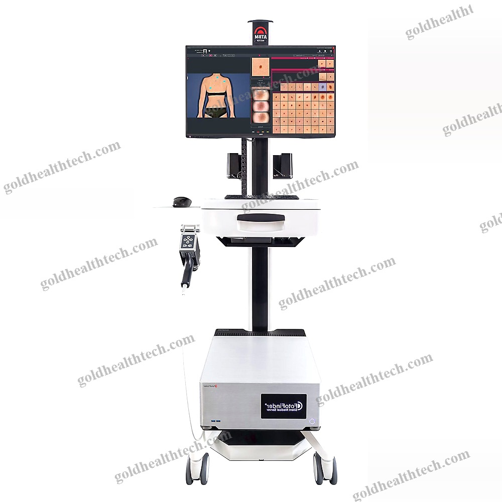 Video Dermatoscope
