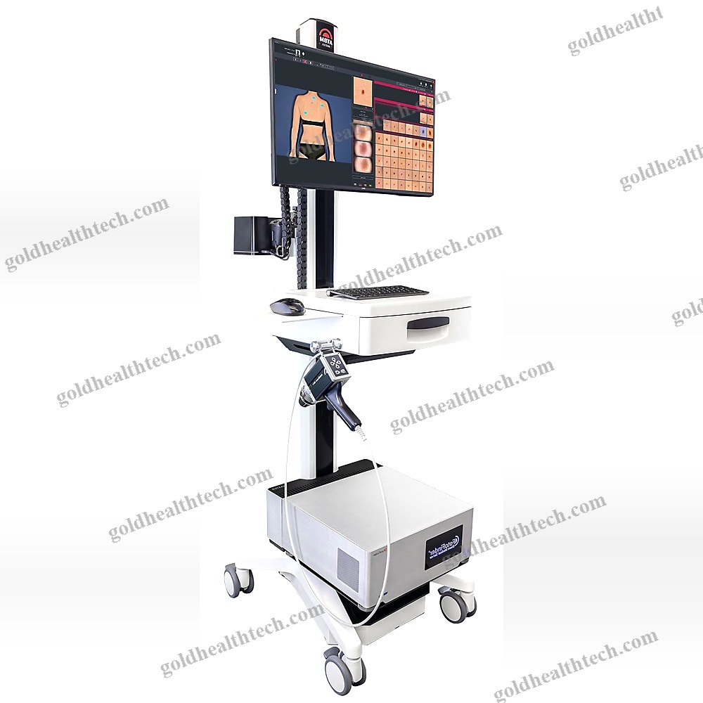 Video Dermatoscope