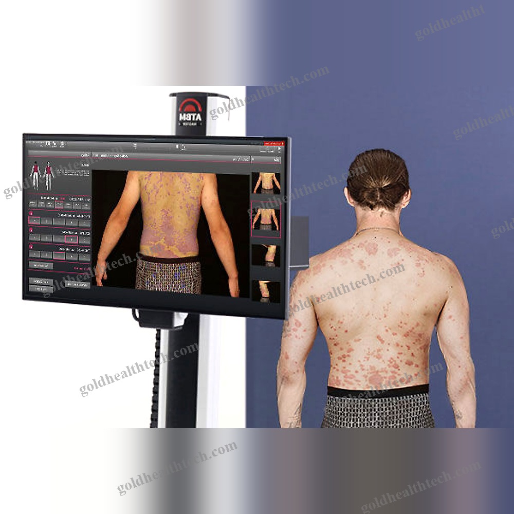 Video Dermatoscope