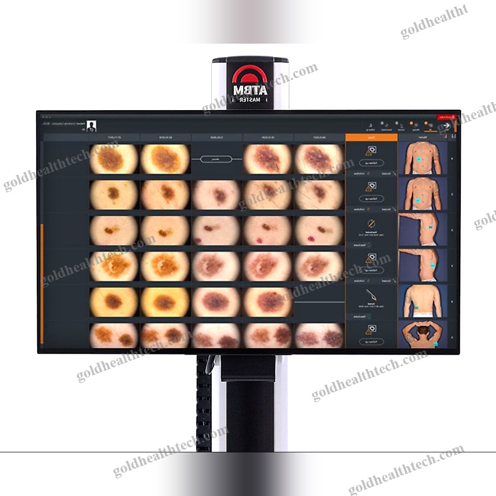 Video Dermatoscope