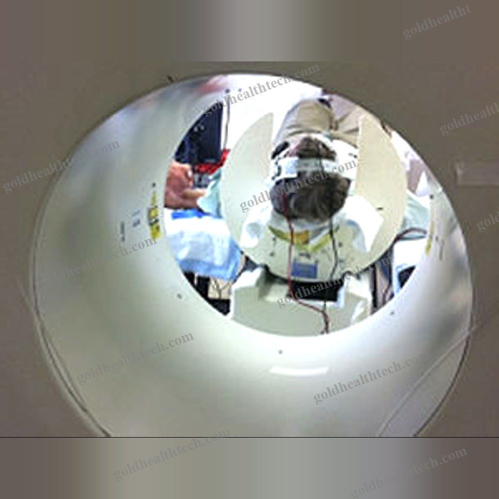 Tdcs Transcranial Electrical Stimulator