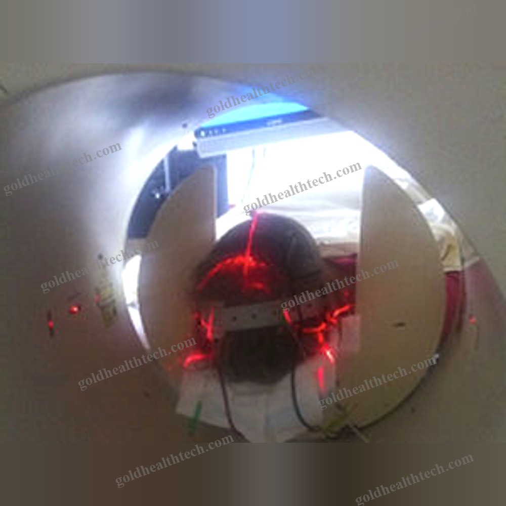 Tdcs Transcranial Electrical Stimulator