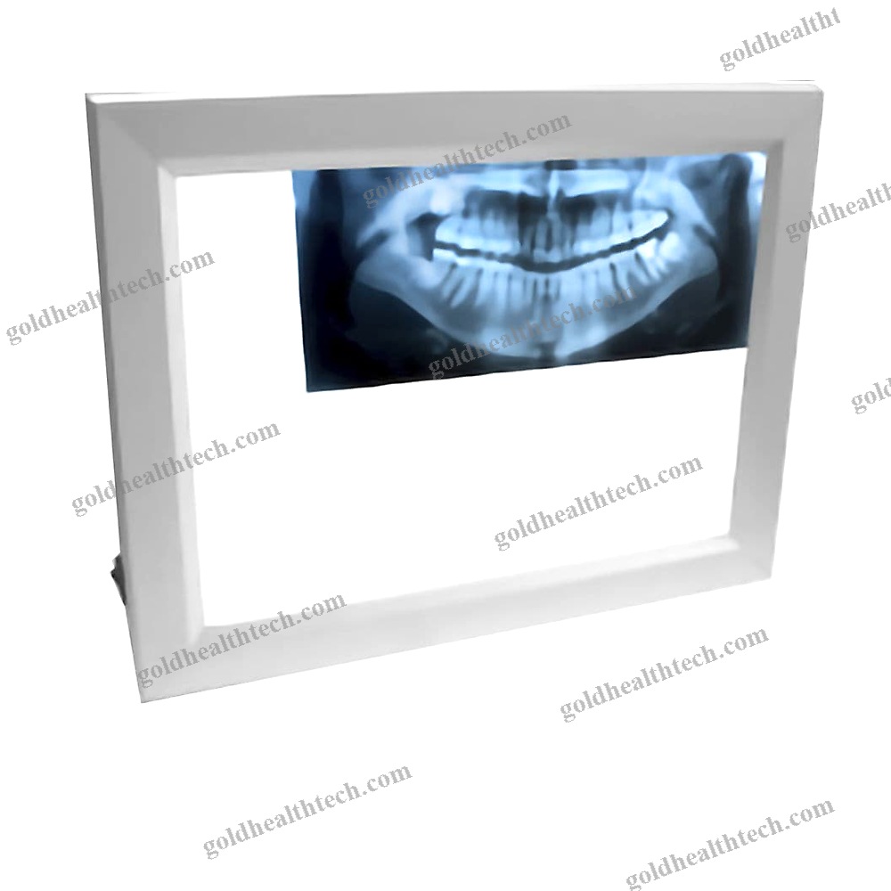 1-Screen X-Ray Film Viewer