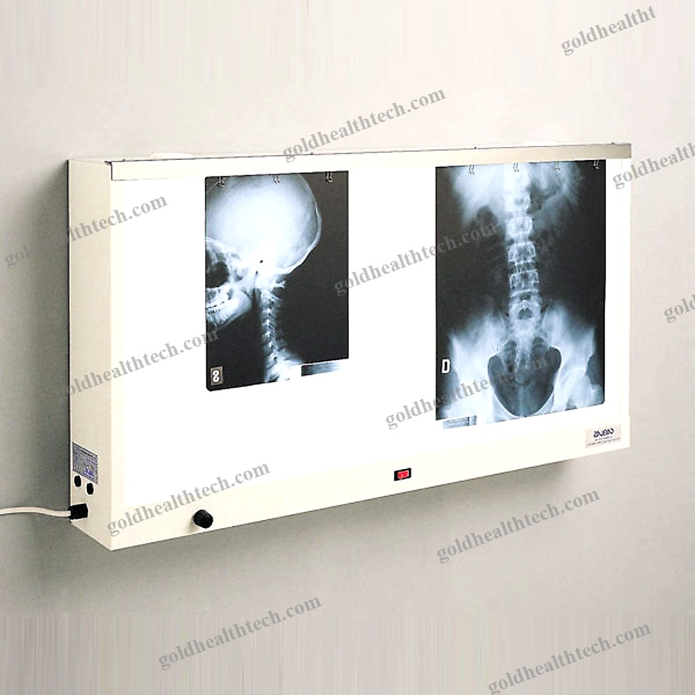 1-Screen X-Ray Film Viewer