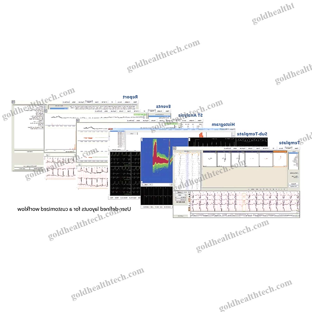 12-Channel Holter Ecg 1
