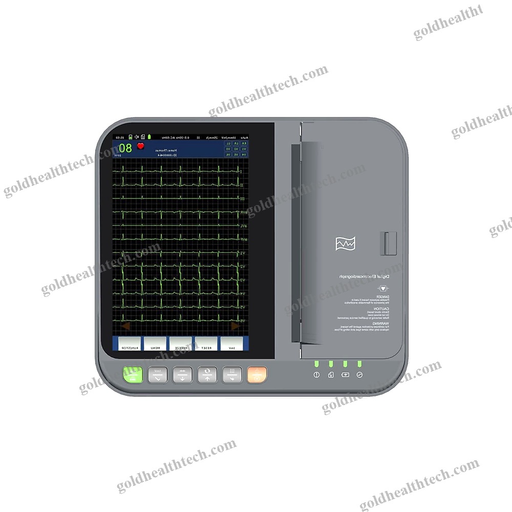 12-Channel Veterinary Ecg System
