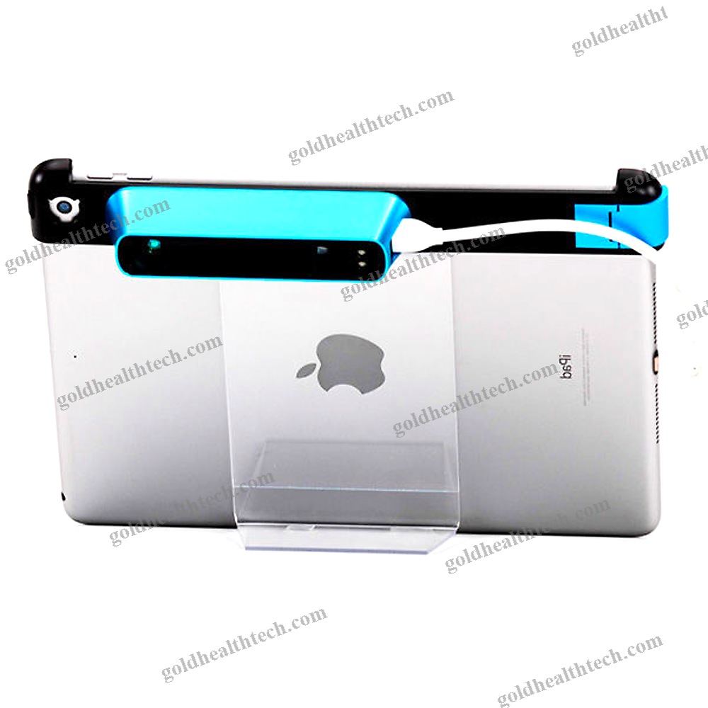 3D Dental Scanner 1