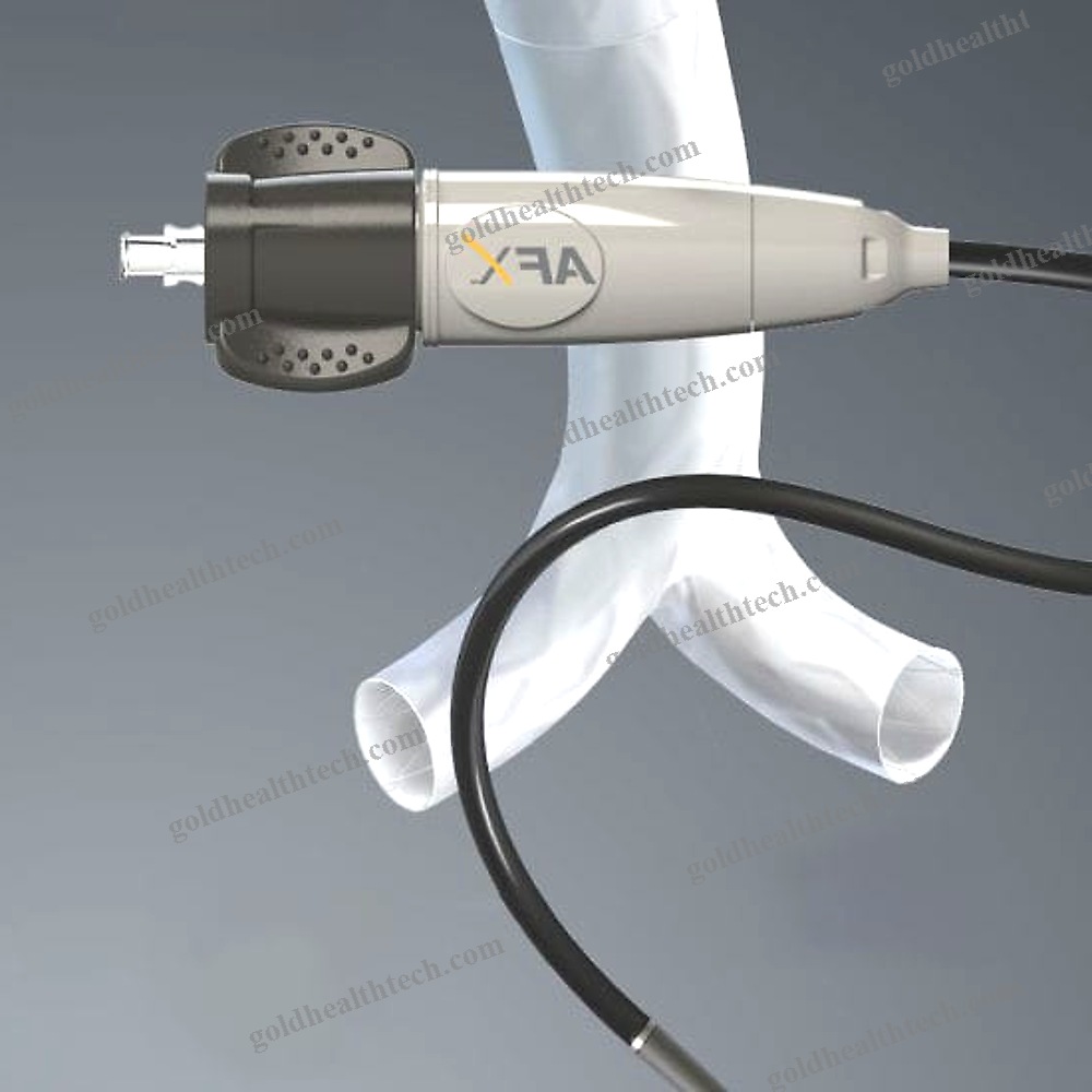 Abdominal Aorta Stent Graft 1