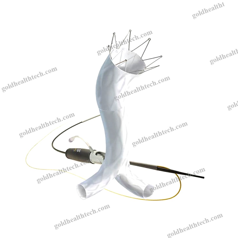 Abdominal Aorta Stent Graft