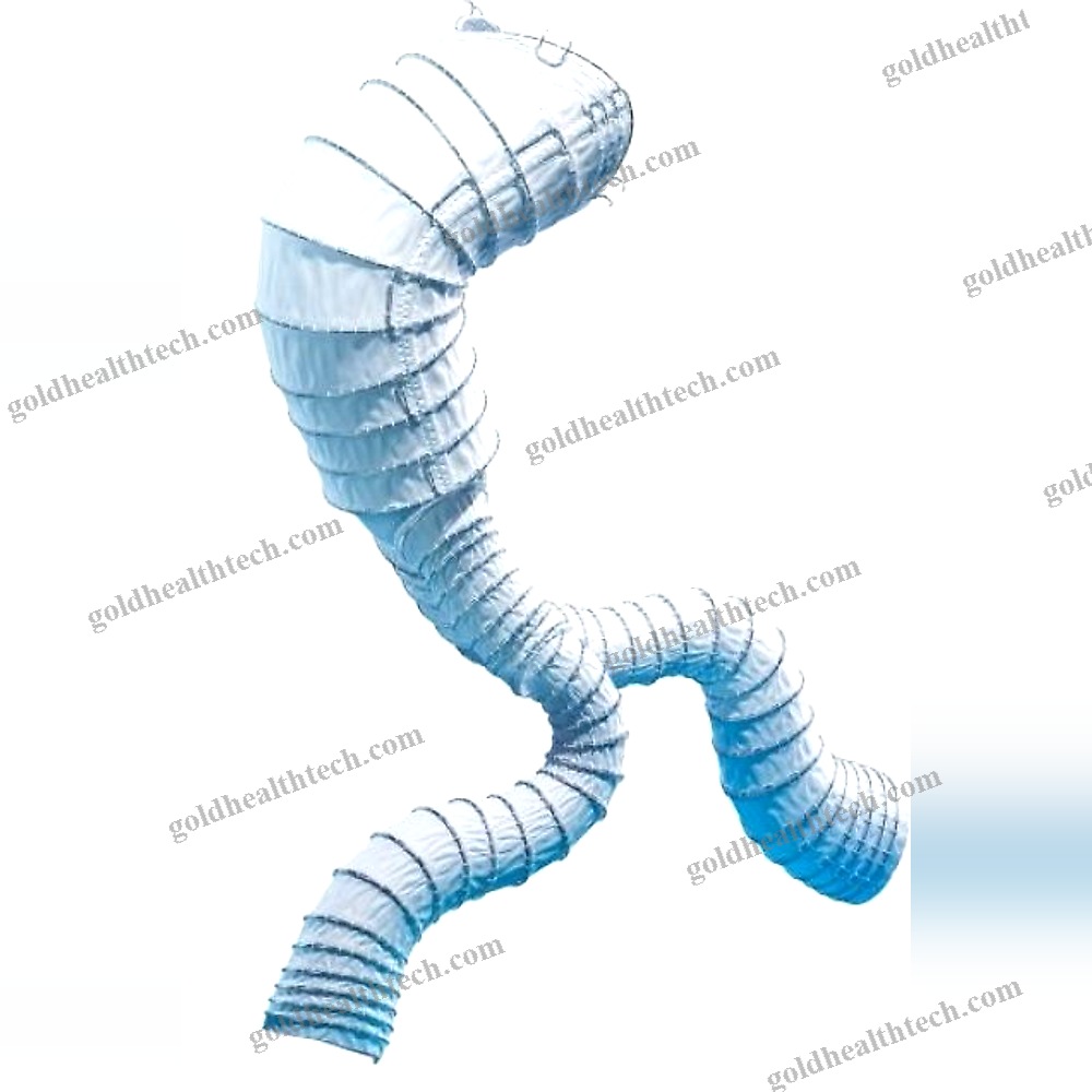 Abdominal Aorta Stent Graft