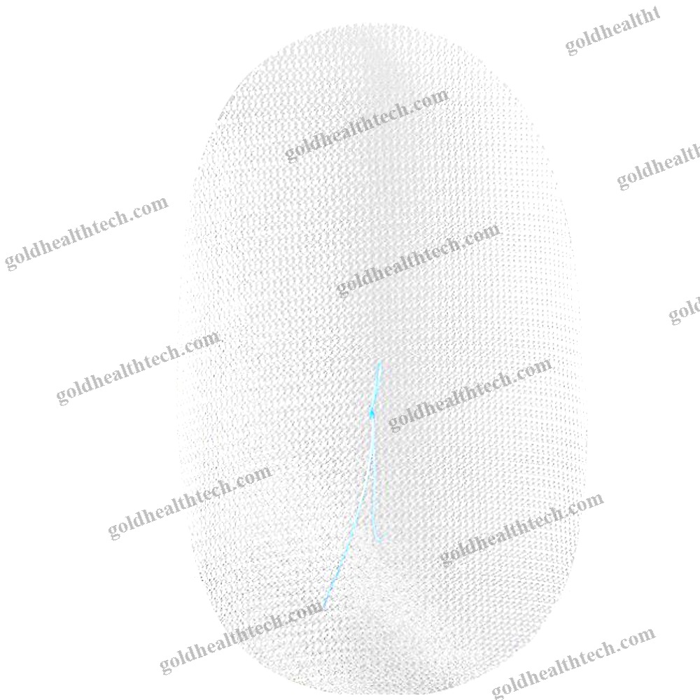 Abdominal Hernia Prosthesis 1