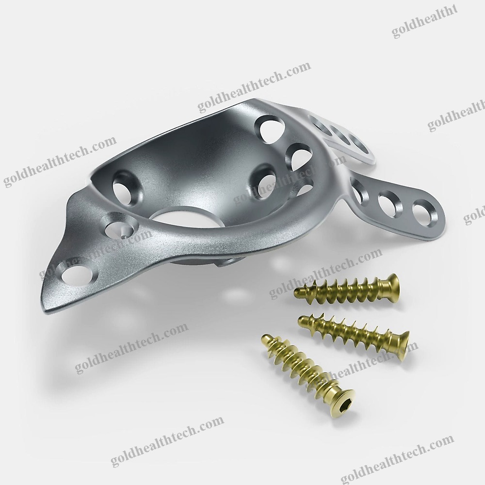 Acetabular Reinforcement