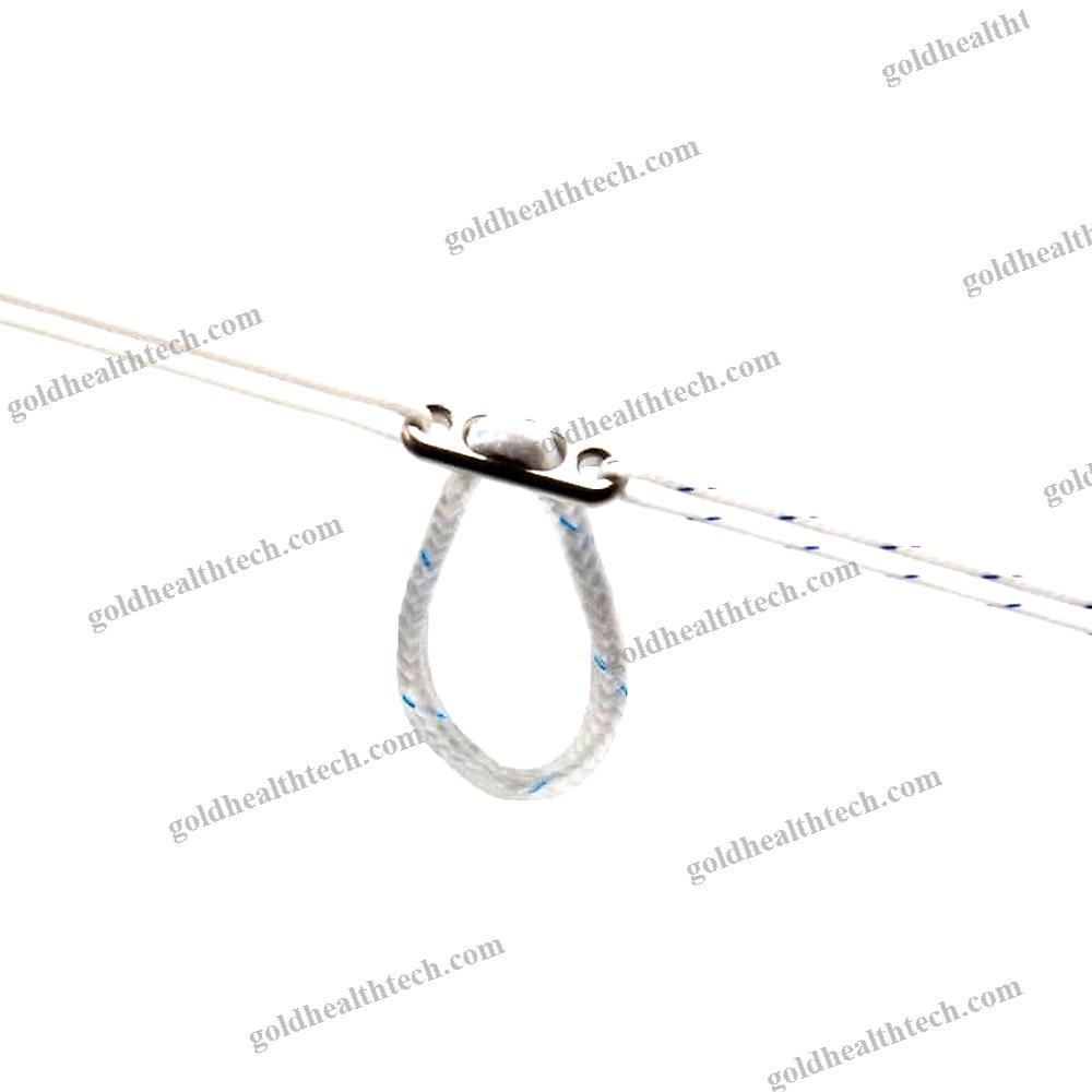 Acl Reconstruction Suture Button