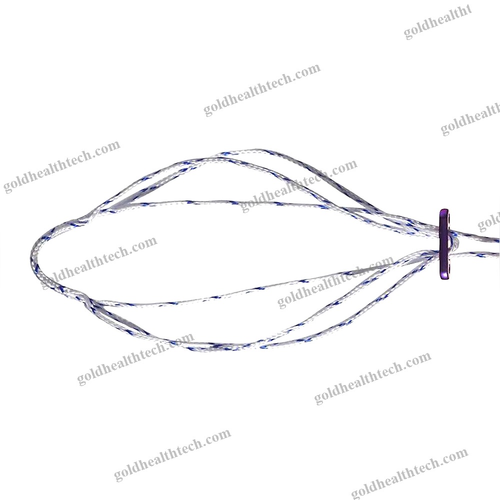 Acl Reconstruction Suture Button