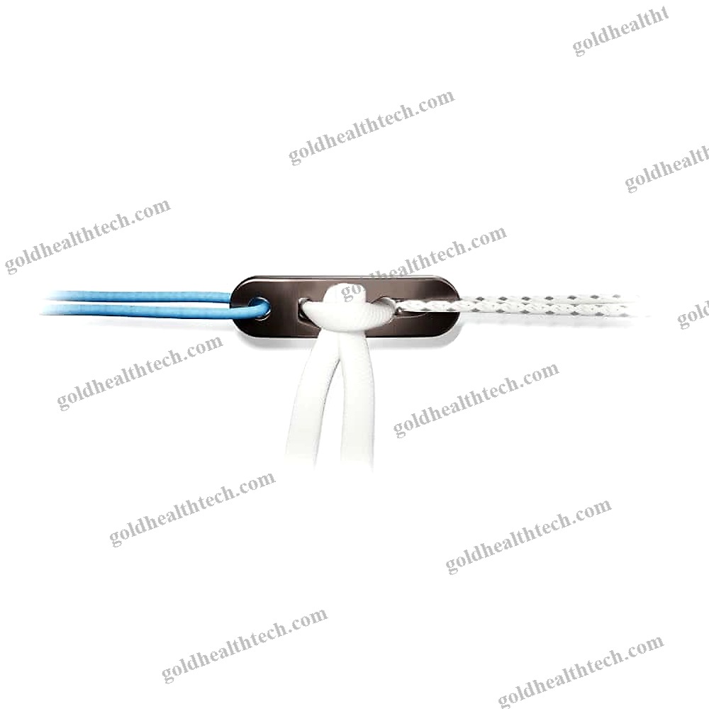 Acl Reconstruction Suture Button