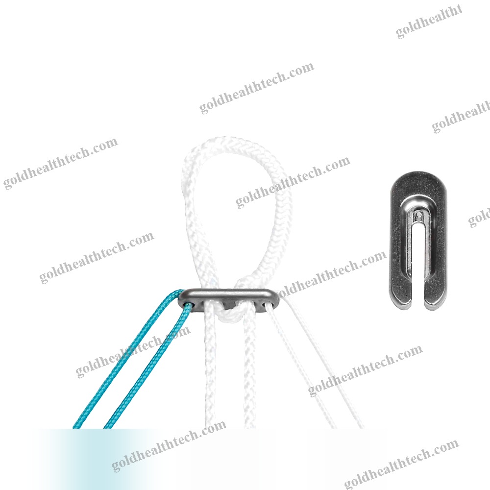 Acl Reconstruction Suture Button 1