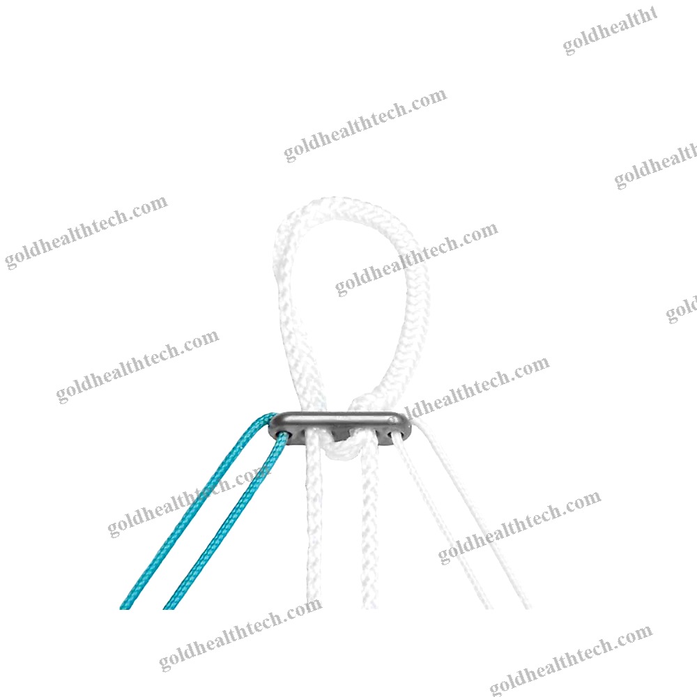 Acl Reconstruction Suture Button