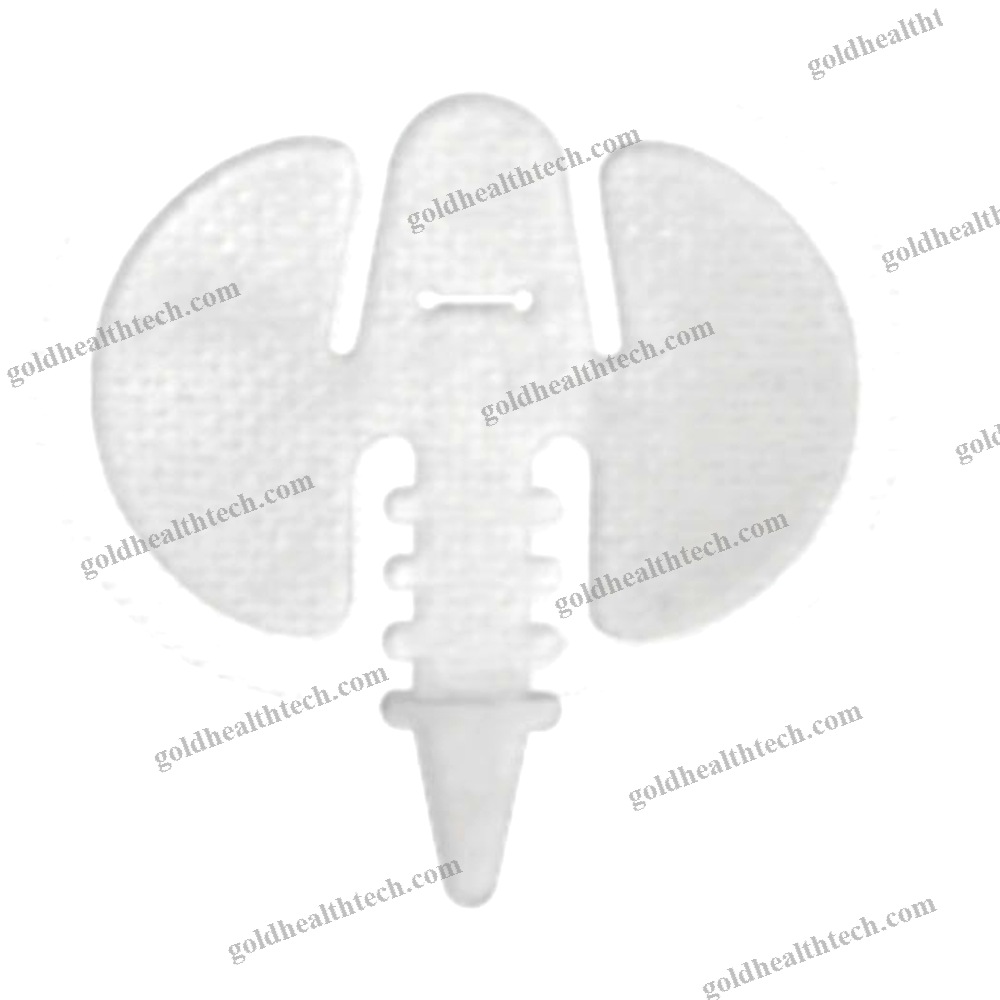 Adhesive Catheter Fixation