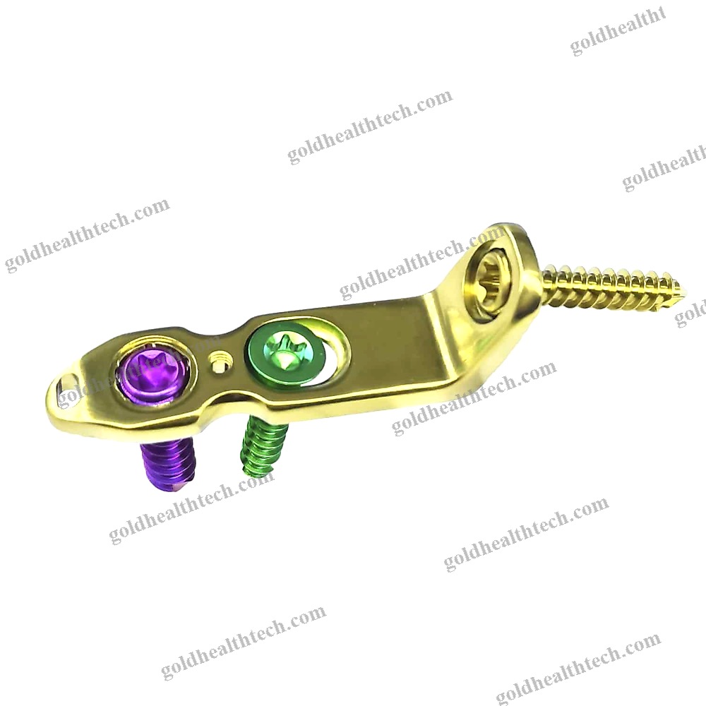 Ankle Osteotomy Plate