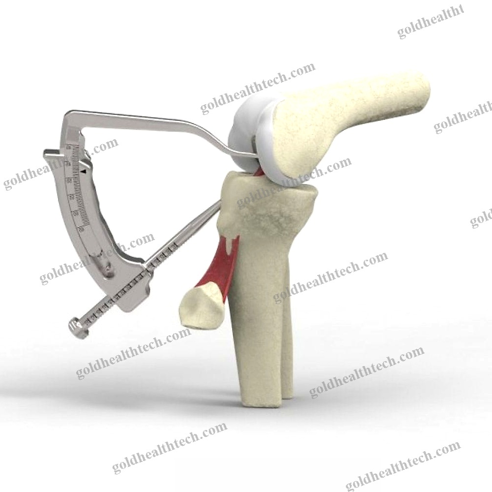 Anterior Cruciate Ligament Reconstruction Instrument Kit