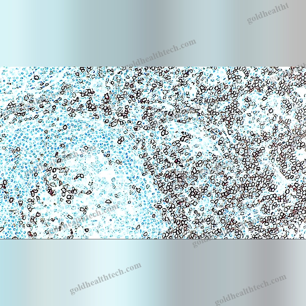Antigen Reagent