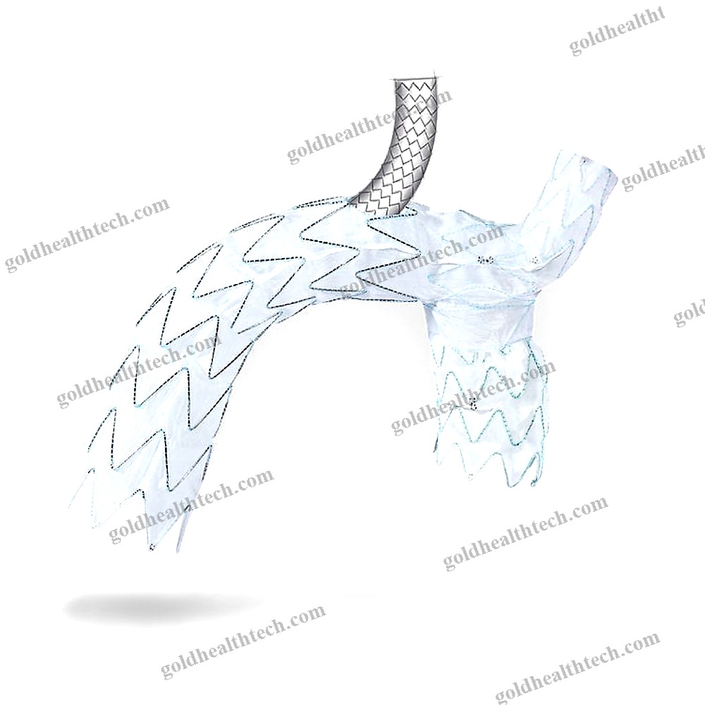 Aortic Arch Stent Graft