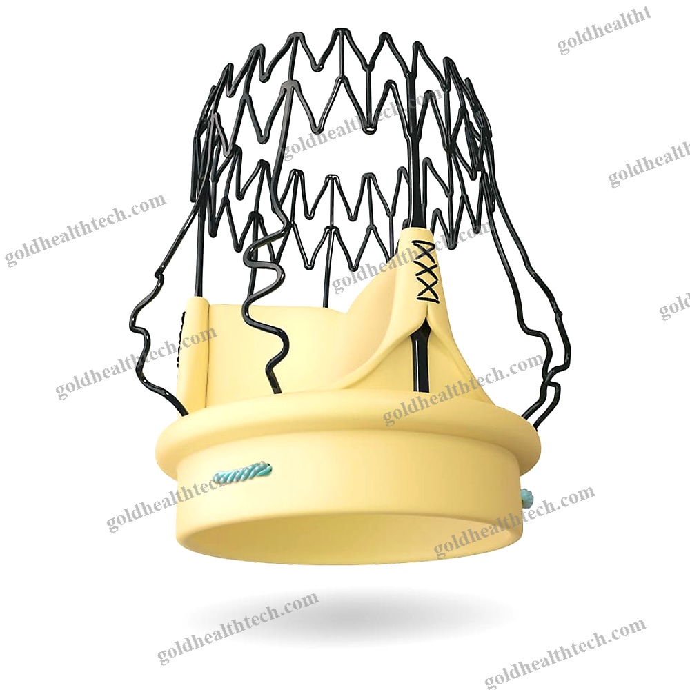 Aortic Valve Bioprosthesis
