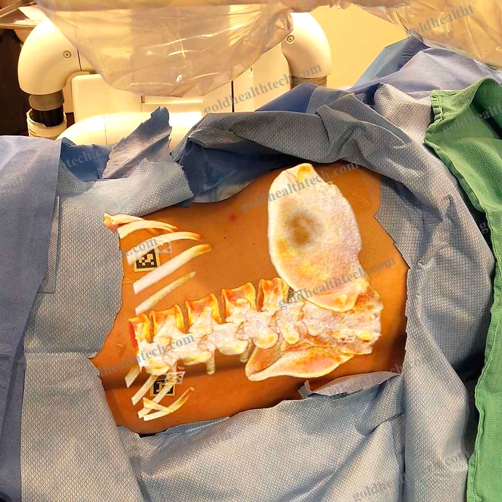 Ar Surgical Navigation System