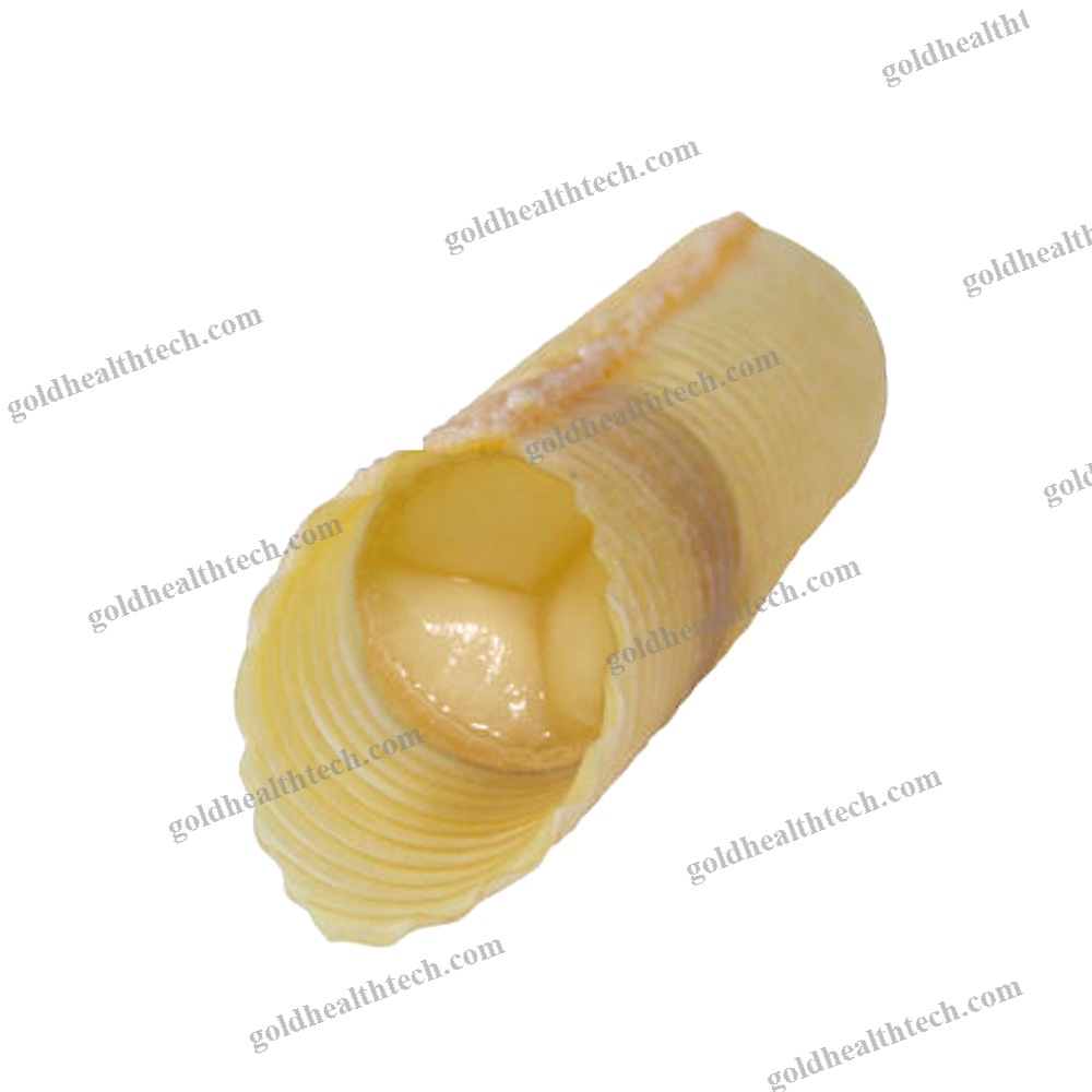 Artery Vascular Bioprosthesis