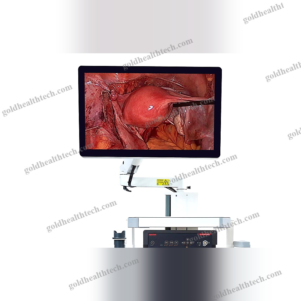 Arthroscopic Endoscopy Column 1