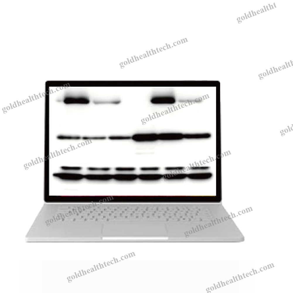 Automatic Molecular Imaging System 1
