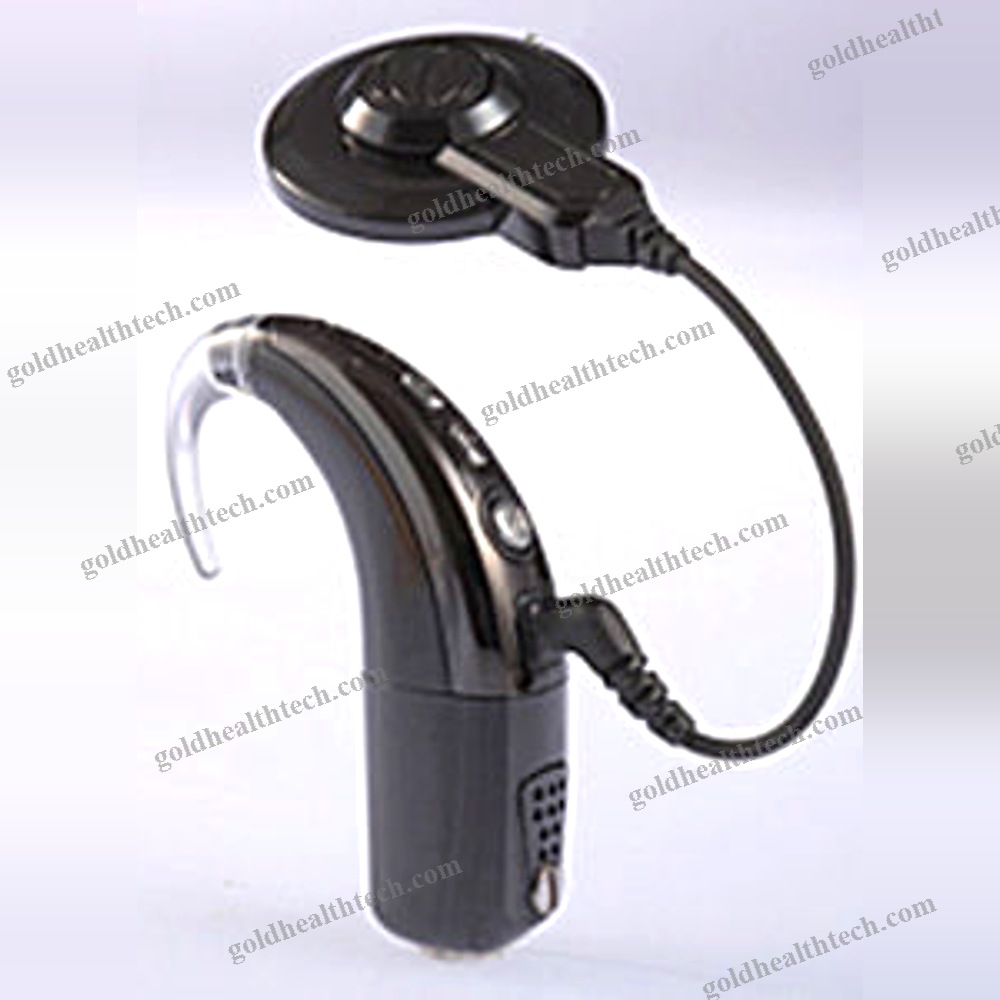 Behind-The-Ear Processor Cochlear Implant