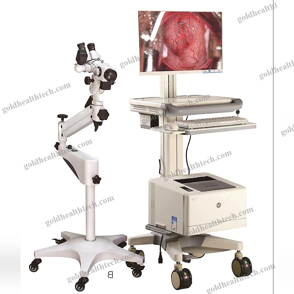 Binocular Colposcope