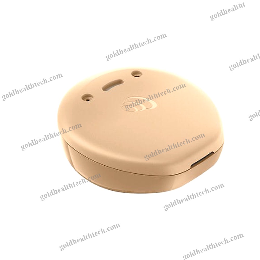 Body-Worn Processor Bone Conduction Implant