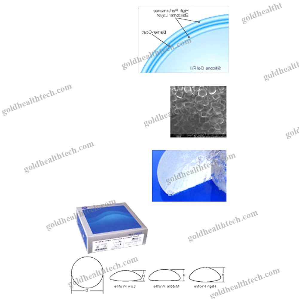 Breast Implant 1